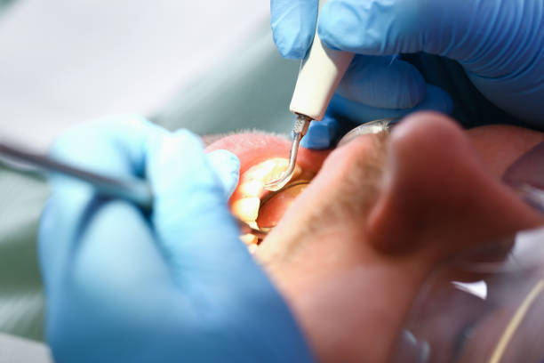 Best Dentist for Dental Trauma  in Maben, MS